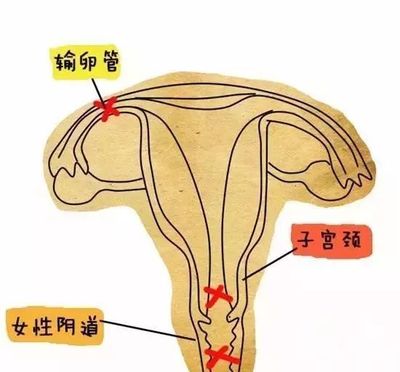 【孕育科普】不可忽视的妇科炎症,它们也是不孕的大敌!