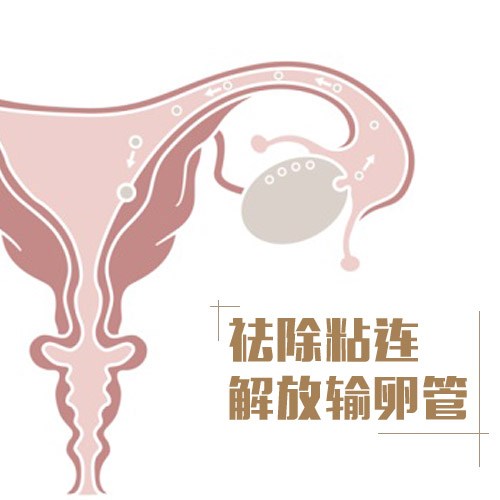 妇女输卵管积水可以怀孕吗