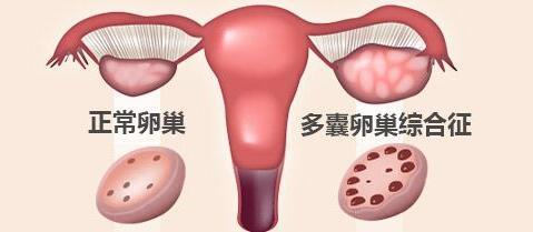 经常吃外卖的人,为什么更容易不孕不育