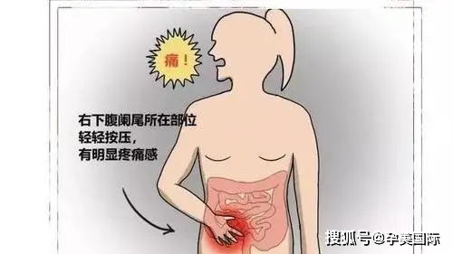 不孕、流产与试管失败 警惕盆腔积液背后的重大影响